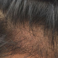 發(fā)際線用戶圖片