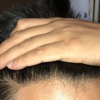 發(fā)際線用戶圖片
