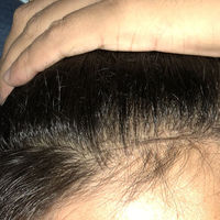 發(fā)際線用戶圖片