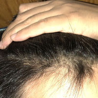 發(fā)際線用戶圖片