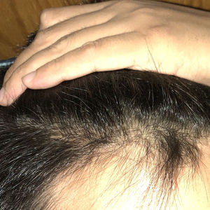 发际线分享社区