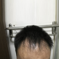 發(fā)際線用戶圖片