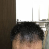 發(fā)際線用戶圖片