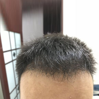 發(fā)際線用戶圖片