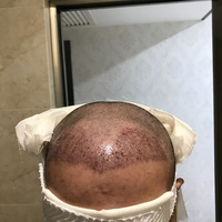 失敗修復(fù)用戶圖片
