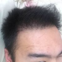 發(fā)際線用戶圖片