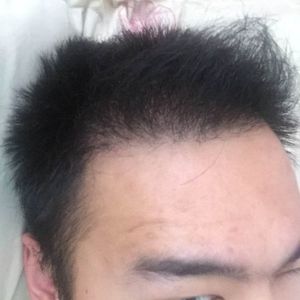 发际线分享社区