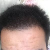 發(fā)際線用戶圖片