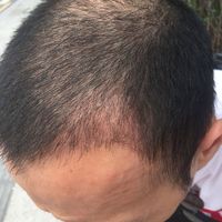 發(fā)際線用戶圖片