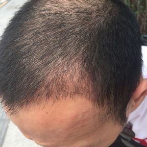 发际线分享社区