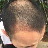發(fā)際線用戶圖片