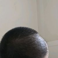 發(fā)際線用戶圖片