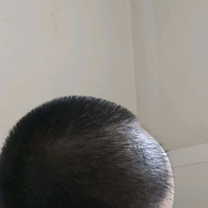 发际线分享社区