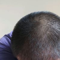 發(fā)際線用戶圖片