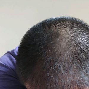 发际线分享社区