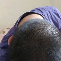 發(fā)際線用戶圖片
