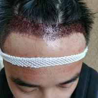 發(fā)際線用戶圖片