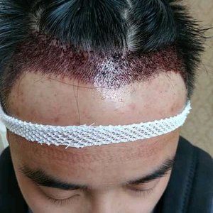 发际线分享社区