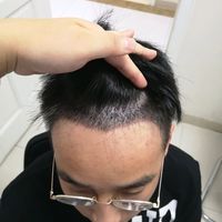 發(fā)際線用戶圖片