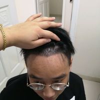 發(fā)際線用戶圖片