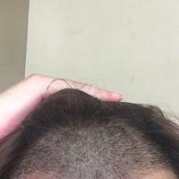 發(fā)際線用戶圖片