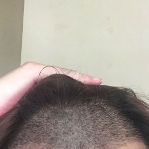 发际线分享社区