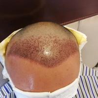 發(fā)際線用戶圖片