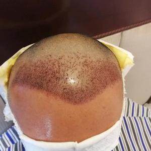 发际线分享社区