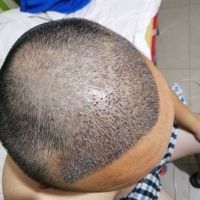 發(fā)際線用戶圖片