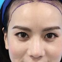 發(fā)際線用戶圖片