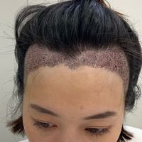 發(fā)際線用戶圖片