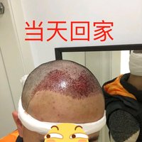 發(fā)際線用戶圖片