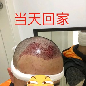 发际线分享社区