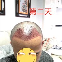 發(fā)際線用戶圖片