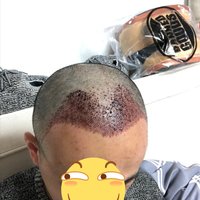 發(fā)際線用戶圖片