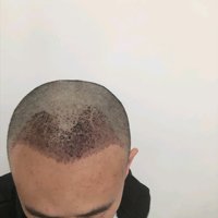 發(fā)際線用戶圖片