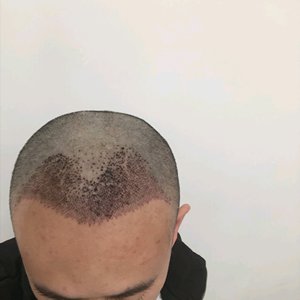 发际线分享社区