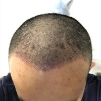 發(fā)際線用戶圖片