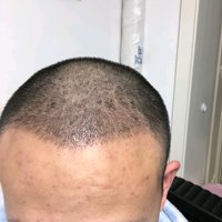 發(fā)際線用戶圖片
