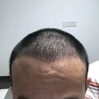 發(fā)際線用戶圖片