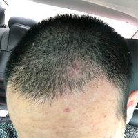 發(fā)際線用戶圖片