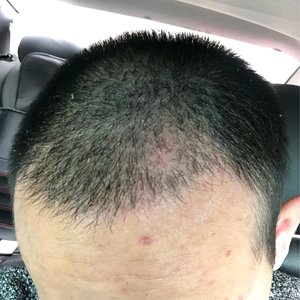 发际线分享社区
