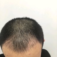 發(fā)際線用戶圖片