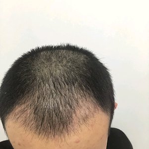 发际线分享社区