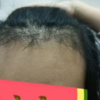發(fā)際線用戶圖片