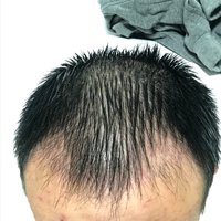 發(fā)際線用戶圖片