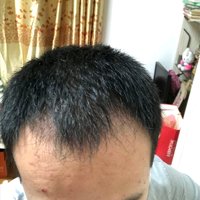 發(fā)際線用戶圖片