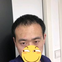 發(fā)際線用戶圖片