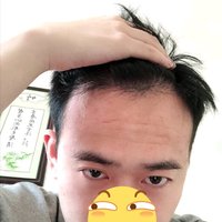 發(fā)際線用戶圖片