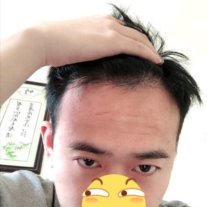 发际线分享社区